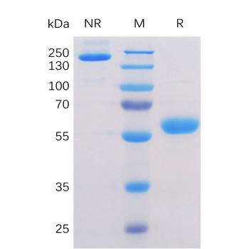 Human TNFSF12 Protein, hFc Tag