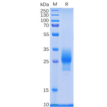 Human 5T4 Protein, His Tag