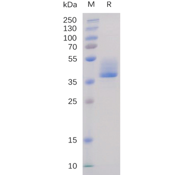 Human CA9 Protein, His Tag