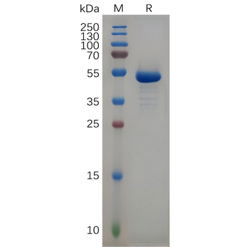 Human ACE2 Protein, His Tag