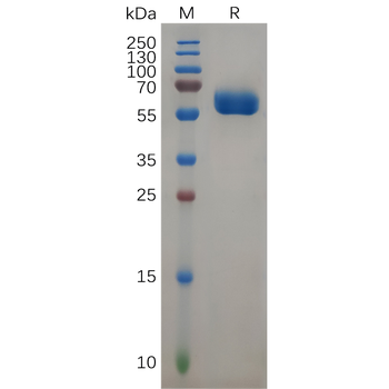Human BCMA Protein, His Tag