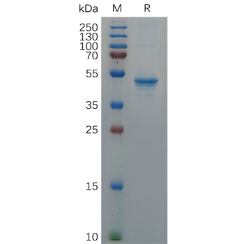Human LAG3 Protein, His Tag