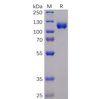 Human CD160 Protein, hFc Tag
