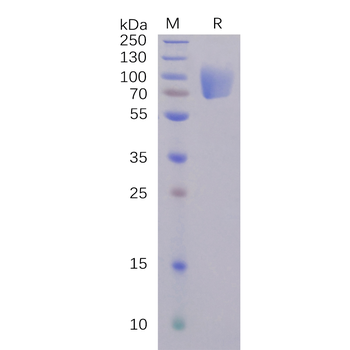 Human PVRIG Protein, hFc Tag