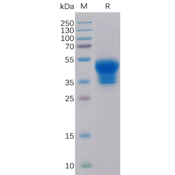 Human IL13RA1 Protein, His Tag