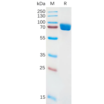 Human ANGPTL3 Protein, His Tag