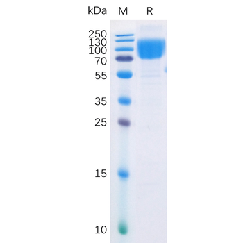 Human CD20 Protein, hFc Tag