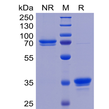 Human B7-H4 Protein, hFc Tag