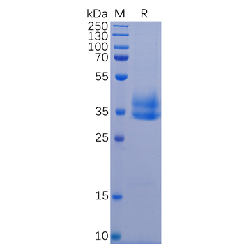 Human AFP Protein, hFc Tag