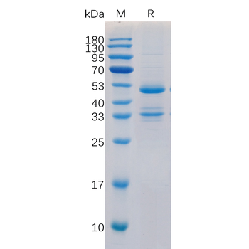 Human FOLR1 Protein, His Tag