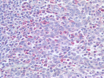PDCD1/CD279/PD-1 Antibody