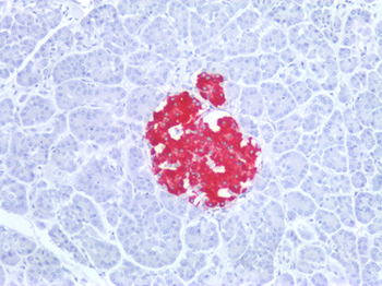 Insulin Antibody