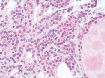 HPSE/Heparanase Antibody