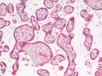 KRT8/CK8/Cytokeratin 8 Antibody