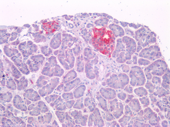 IAPP/Amylin Antibody