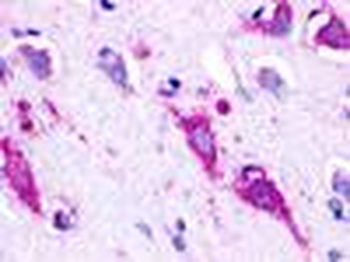 GPR22 Antibody