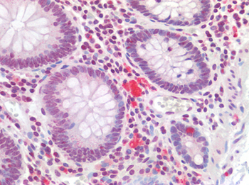 HOXA10 Antibody