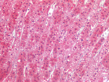 TIAM1 Antibody