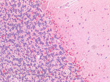 HEXB Antibody