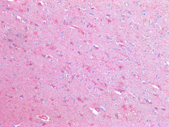 HEXB Antibody