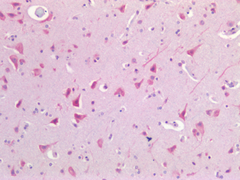 USP19 Antibody