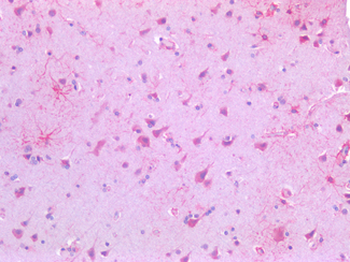 USP19 Antibody