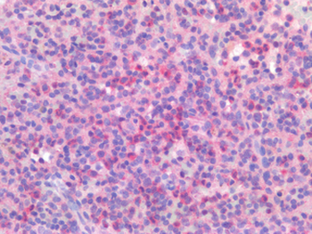 IL23R Antibody