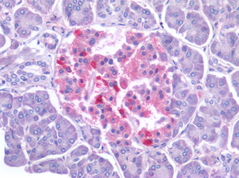 NKX6-1 Antibody
