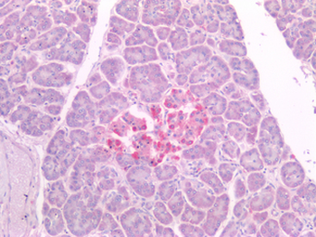 NKX6-1 Antibody