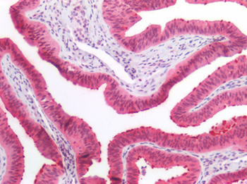 CCDC6 Antibody