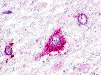 GPR22 Antibody