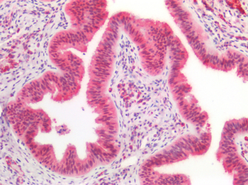 CCDC6 Antibody