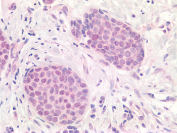 APOBEC3B Antibody