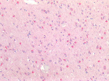 MAPRE2/EB2 Antibody