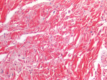 RAB7A/RAB7 Antibody