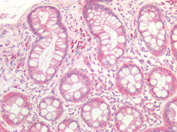 GDF15 Antibody