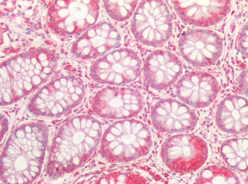 ZFP91 Antibody