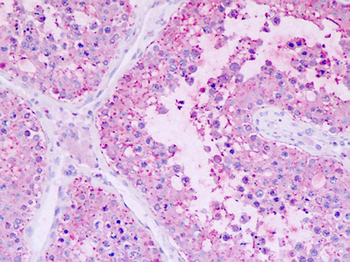 GPR22 Antibody