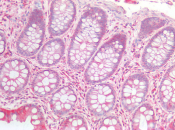NTN1/Netrin 1 Antibody