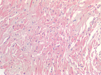 NTN1/Netrin 1 Antibody