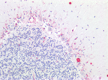 ADGRL1/LPHN1 Antibody