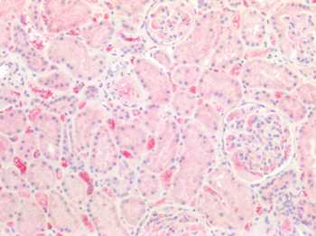 CALML3 Antibody