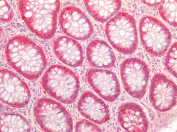 MLPH/Melanophilin Antibody