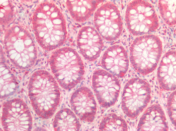 MLPH/Melanophilin Antibody