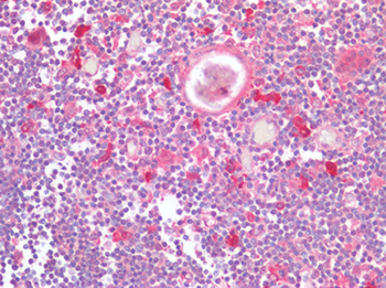 CCR5 Antibody