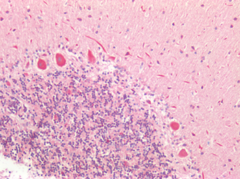GRB7 Antibody