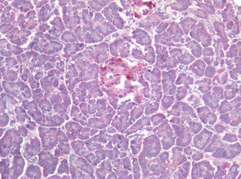 SST/Somatostatin Antibody