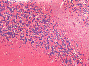UCHL1/PGP9.5 Antibody