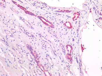 UCHL1/PGP9.5 Antibody