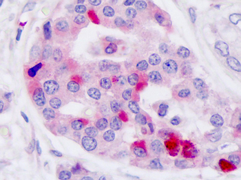 GLP1R/GLP-1 Receptor Antibody
